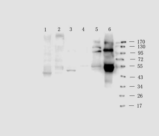 IRAK4 antibody