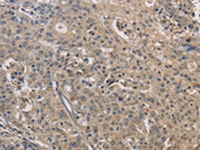 IRAK4 Antibody