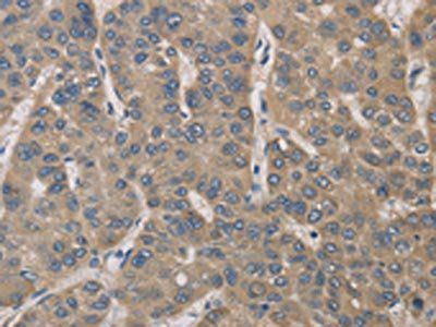 IRAK4 Antibody