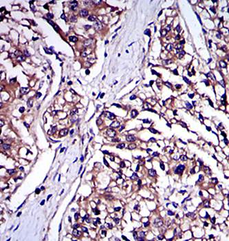 IRAK4 Antibody