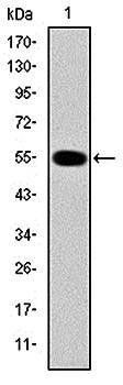 IRAK4 Antibody