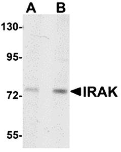 IRAK Monoclonal Antibody