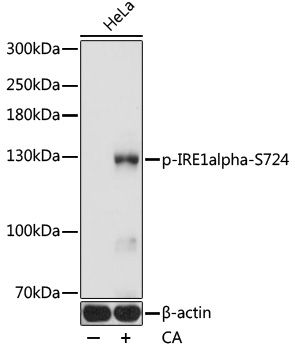 IRE1alpha (Phospho-S724) antibody