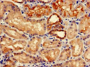 IREB2 Antibody
