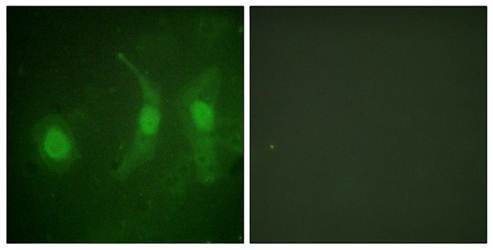 IRF-3 (phospho-Ser385) antibody