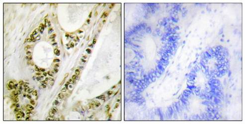 IRF-3 (Phospho-Ser385) Antibody