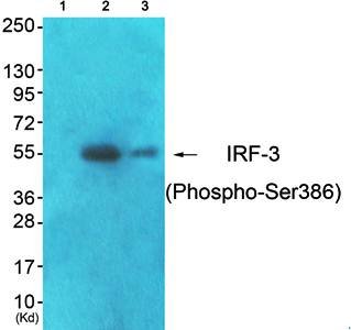 IRF-3 (Phospho-Ser386) Antibody