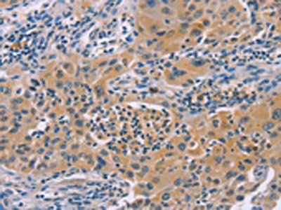 IRF3 Antibody