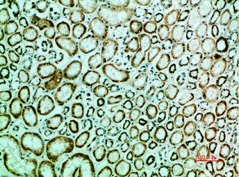 IRF3 Antibody