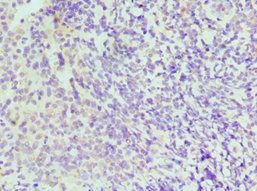 IRF4 Antibody