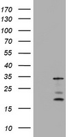 IRF5 Antibody