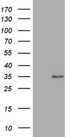 IRF5 Antibody