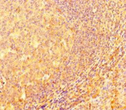 IRF5 Antibody