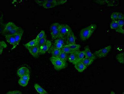 IRF6 Antibody