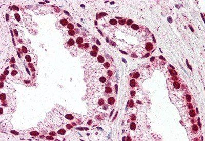 Goat anti-IRF6 Antibody