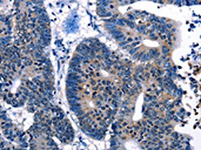 IRF7 Antibody