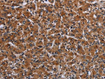 IRGM Antibody
