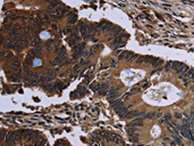 IRGM Antibody