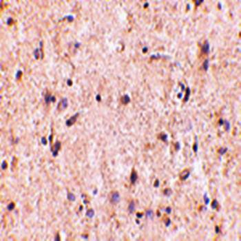 IRGM Antibody