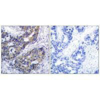 IRS1 (Ab-312) antibody