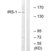 IRS1 (Ab-312) antibody