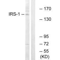 IRS1 (Ab-312) Antibody