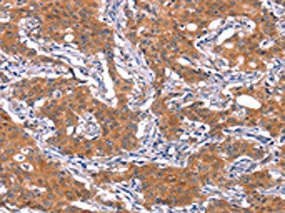 IRS1 Antibody