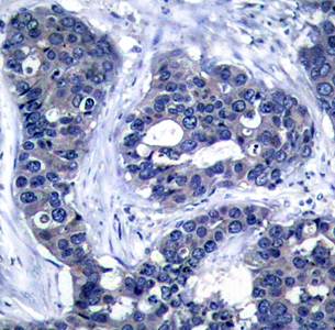 IRS (Phospho-Ser639) Antibody