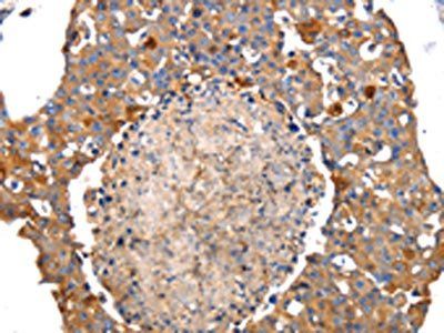 IRS2 Antibody