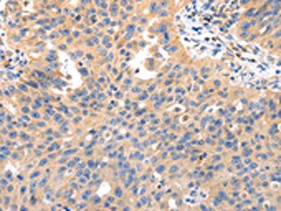 IRS2 Antibody