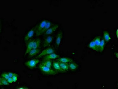 IRS2 Antibody