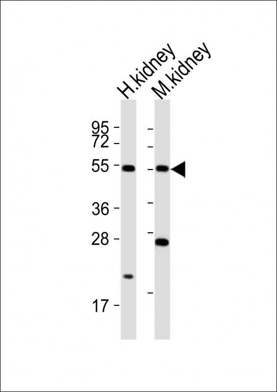IRX1 antibody