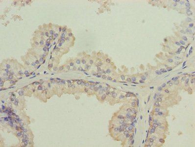 ISCA2 Antibody