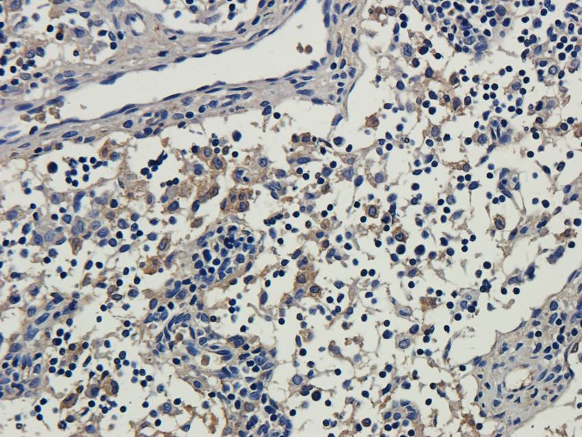 ISG15 antibody