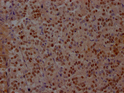 Islet 1 antibody