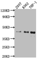 Islet 1 antibody