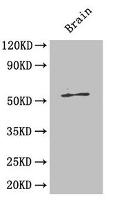 Islet cell autoantigen 1 antibody