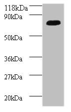 Islet cell autoantigen 1 antibody