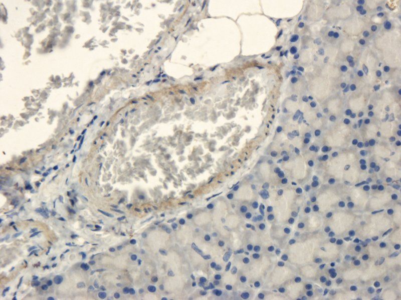 Islet 1 antibody