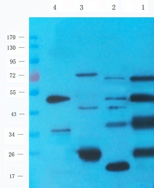 Islet 1 antibody