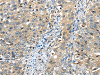 ISM2 Antibody