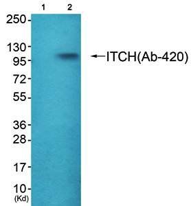 ITCH (Ab-420) Antibody
