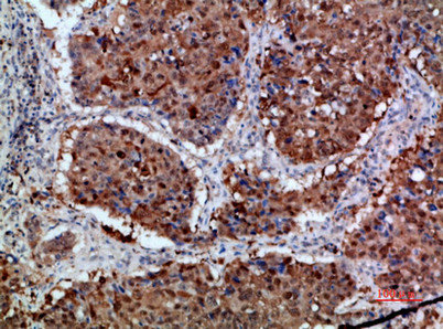 ITGA1 antibody