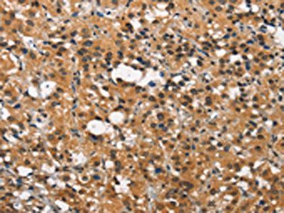 ITGA2 Antibody