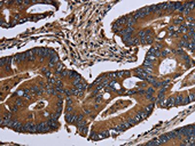 ITGA2B Antibody