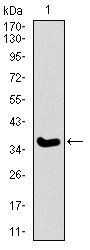 ITGA2B