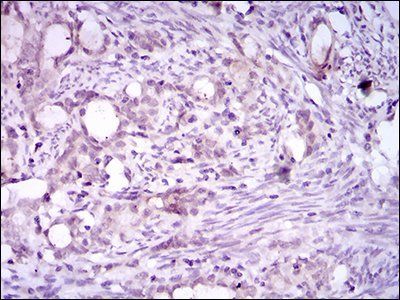 ITGA2B Antibody