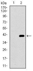 ITGA2B