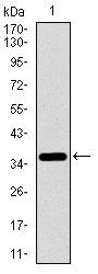 ITGA2B