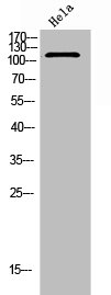 ITGA5 Antibody
